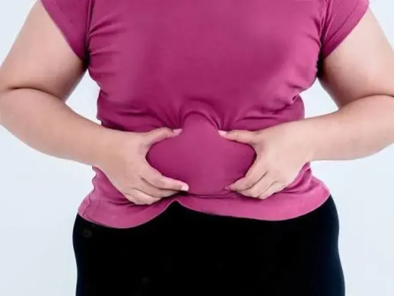 تراكم الدهون