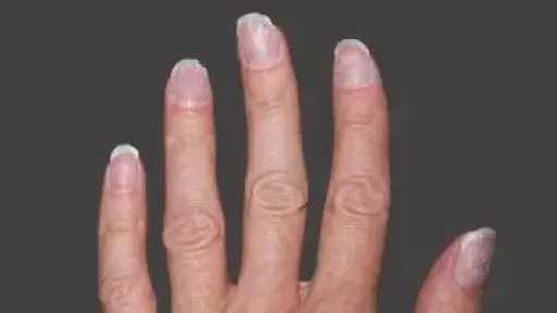 لون أظافرك يعكس صحتك.. علامات خطيرة لا يجب تجاهلها لون أظافرك يعكس صحتك.. علامات خطيرة لا يجب تجاهلها