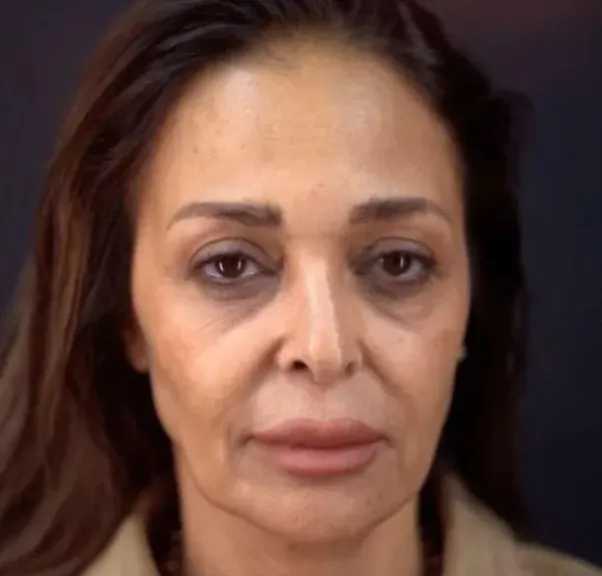 داليا البحيري تفاجئ جمهورها بعد عملية التجميل الأخيرة