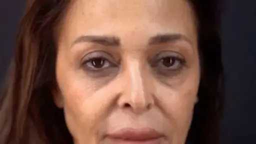 داليا البحيري تفاجئ جمهورها بعد عملية التجميل الأخيرة داليا البحيري تفاجئ جمهورها بعد عملية التجميل الأخيرة