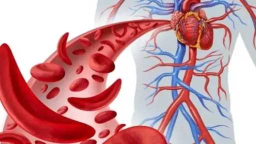 فقر الدم عند النساء.. دليل شامل لفهم الأسباب والأعراض وكيفية الوقاية والعلاج