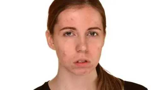 أخطاء شائعة تؤثر على صحة البشرة خلال رمضان.. كيف تحمي بشرتك؟