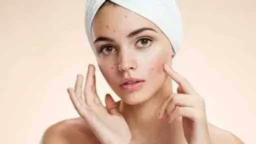 التغيرات الهرمونية.. السبب وراء ظهور البثور قبل الدورة الشهرية