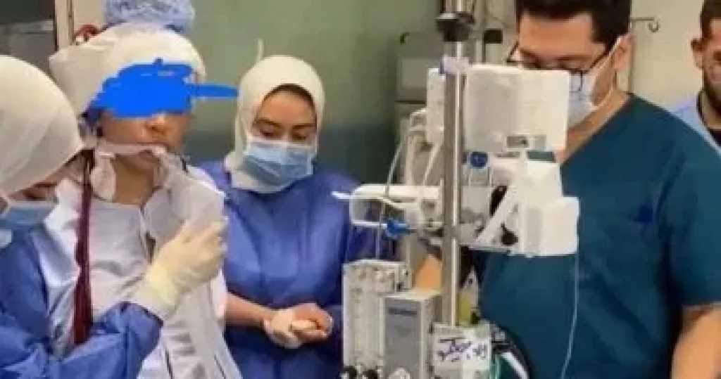 إنقاذ أم وطفلها بتدخل طبي فريد في قصر العيني باستخدام تقنية الإيكمو المتقدمة
