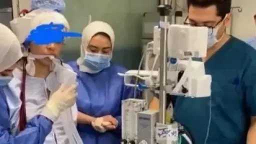 إنقاذ أم وطفلها بتدخل طبي فريد في قصر العيني باستخدام تقنية الإيكمو المتقدمة