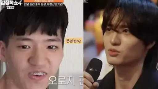 شاب كوري يثير جدلا حول تغيير مظهره لأنثى دون جراحة تجميل