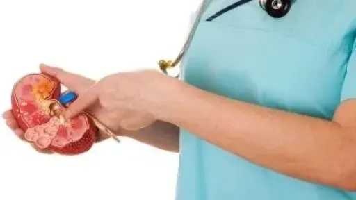 لماذا تزداد حصوات الكلى بين الرجال؟.. خبراء يوضحون الأسباب وطرق الوقاية