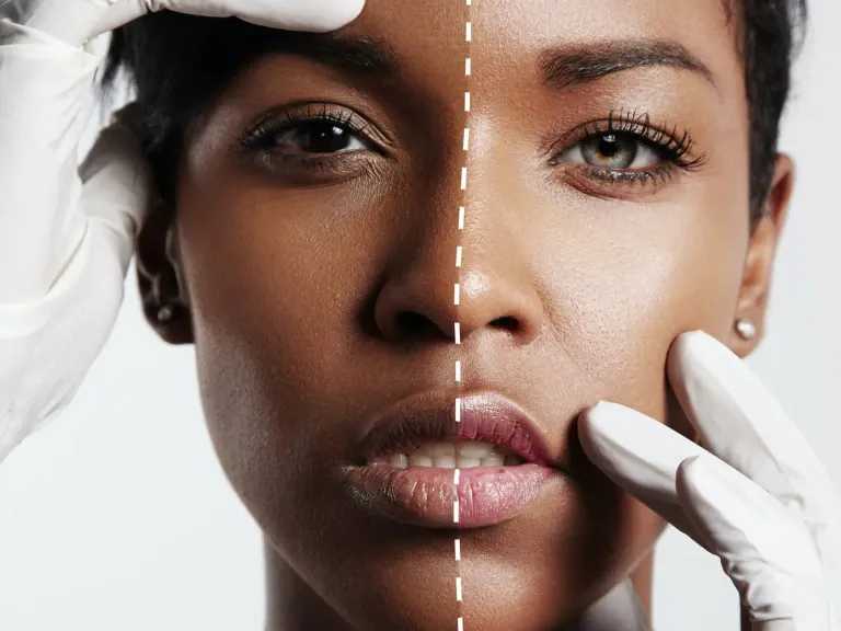 وصفات طبيعية لتفتيح البشرة استعدادًا لعيد الفطر