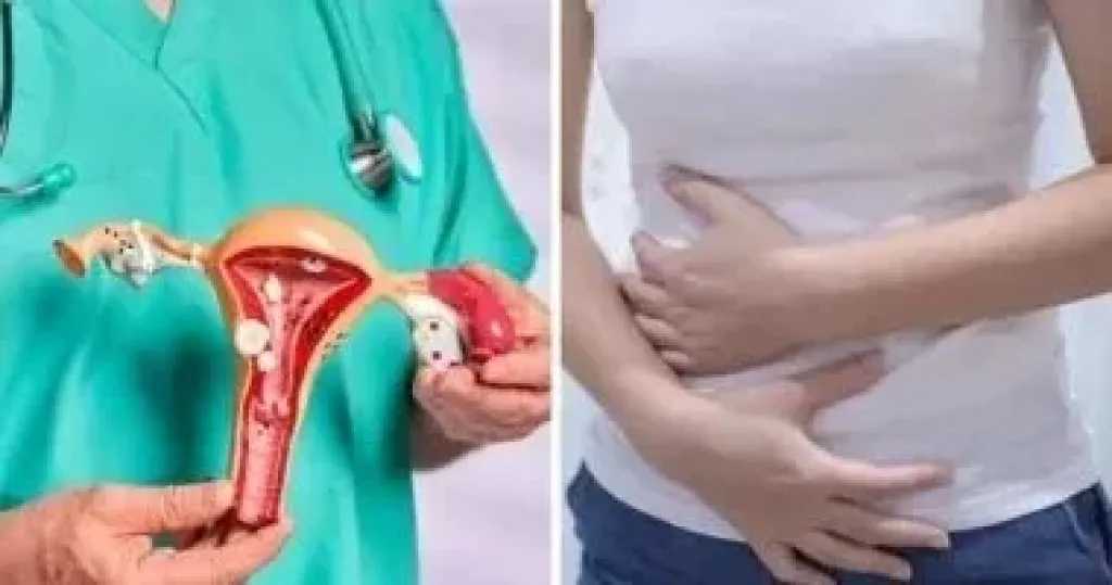 بطانة الرحم المهاجرة.. اضطراب صحي يعيد تشكيل الحياة اليومية ويؤثر على الخصوبة