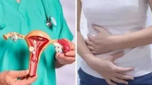 بطانة الرحم المهاجرة.. اضطراب صحي يعيد تشكيل الحياة اليومية ويؤثر على الخصوبة