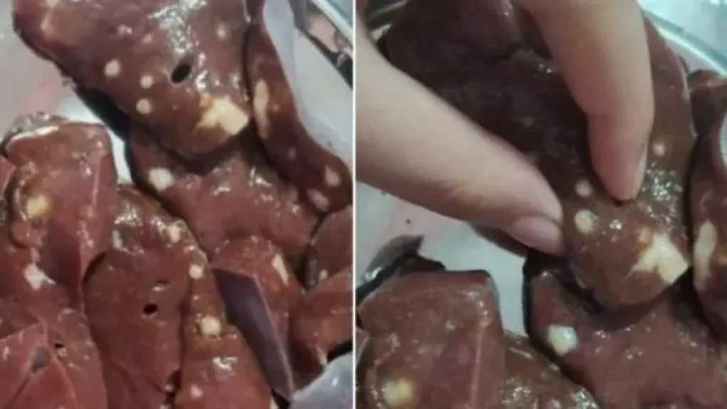 الكبدة الفاسدة تهدد الصحة.. 6 علامات تحذيرية عليك معرفتها