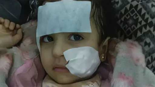 تفاصيل جديدة حول حادثة طفلة السيرك: كاميرات المراقبة تكشف الحقائق