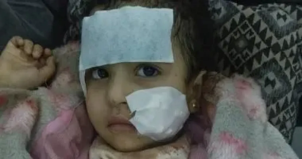 طفلة السيرك 