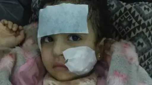 كاميرات المراقبة تفجر مفاجأت صادمة فى واقعة طفلة السيرك