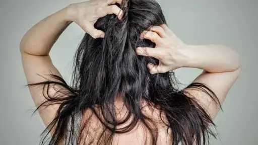 نصائح العناية بفروة الرأس لضمان صحة شعر قوية وكثيفة
