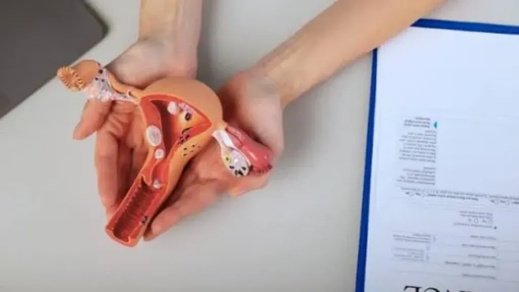 الرحم ذو القرنين