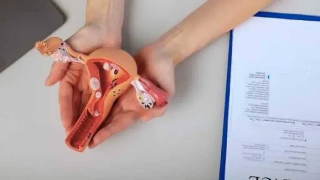 الرحم ذو القرنين.. حالة خلقية نادرة تتطلب متابعة دقيقة أثناء الحمل