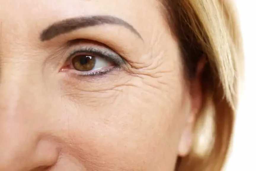 ماسكات طبيعية لمكافحة التجاعيد وتعزيز نضارة البشرة