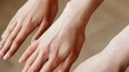 بمكونات منزلية.. وصفات طبيعية لتفتيح اليدين وحمايتها من الاسمرار