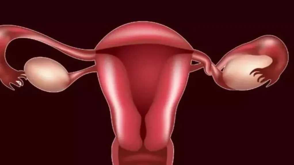 خطر تكيس المبايض والتواء المبيض.. تعرفي على الأعراض والأسباب