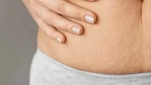 هترجعي شباب.. طرق طبيعية لتقليل السيلوليت وتحسين مظهر البشرة