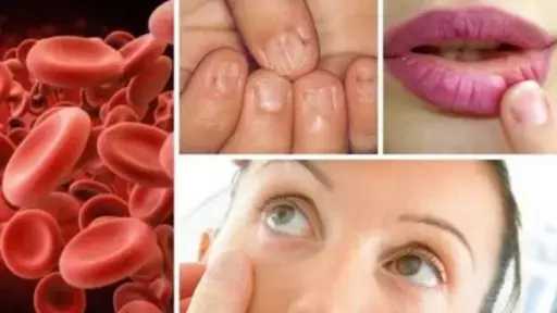 المرأة والصحة.. كيف تحمي نفسك من نقص الحديد؟