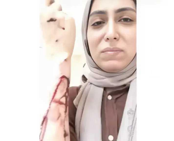 نقابة الأطباء تدين الاعتداء على طبيبة أسنان بشبرا وتطالب بحماية عاجلة للأطقم الطبية