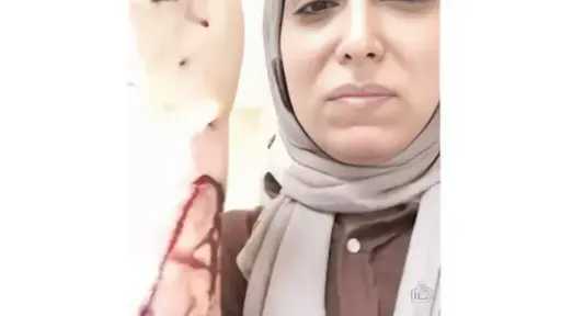 نقابة الأطباء تدين الاعتداء على طبيبة أسنان بشبرا وتطالب بحماية عاجلة للأطقم الطبية