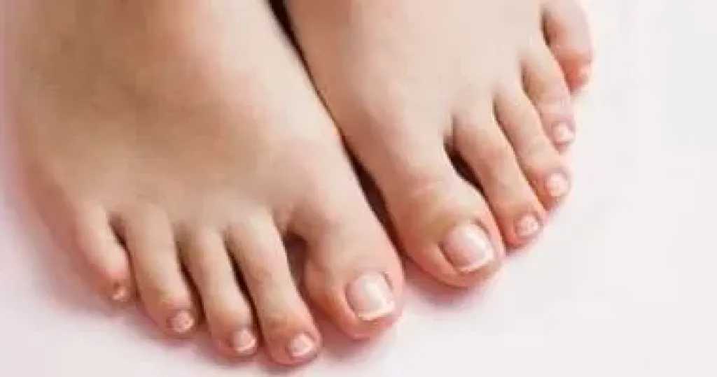 وصفات طبيعية لتفتيح اليدين والقدمين.. حلول بسيطة لعلاج اسمرار الصيف