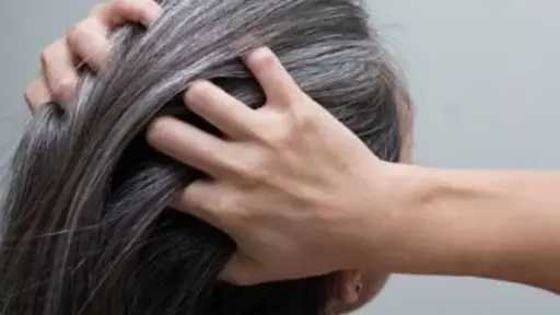 الشيب المبكر.. أزمة جمالية وصحية تواجه الفتيات