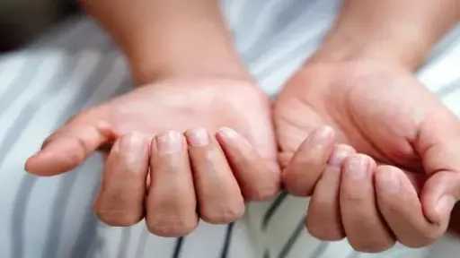 نقص الحديد لدي النساء.. الأسباب والأعراض وطرق العلاج بالغذاء