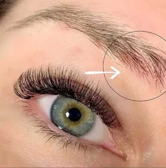 بمكونات منزلية.. كيفية علاج قشرة الحاجبين بطرق طبيعية