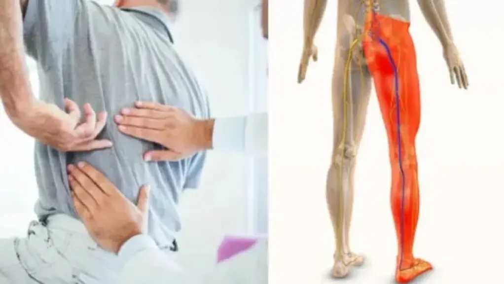 ألم ساقكِ قد يكون سببه العمود الفقري.. علامات تكشف الإصابة بعرق النسا