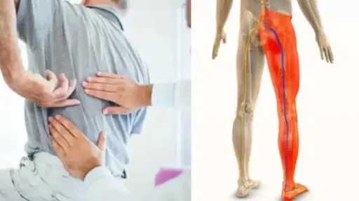 ألم ساقكِ قد يكون سببه العمود الفقري.. علامات تكشف الإصابة بعرق النسا ألم ساقكِ قد يكون سببه العمود الفقري.. علامات تكشف الإصابة بعرق النسا