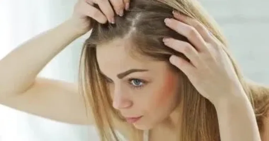 نمو الشعر 