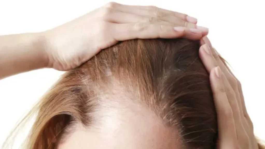 النظام الغذائي السليم.. مفتاح الحفاظ على صحة الشعر