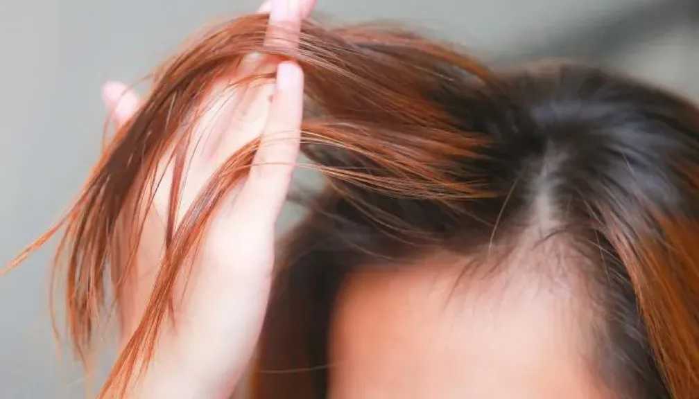 أسباب تساقط الشعر في الصيف.. هل الحرارة والعرق والبحر السبب؟