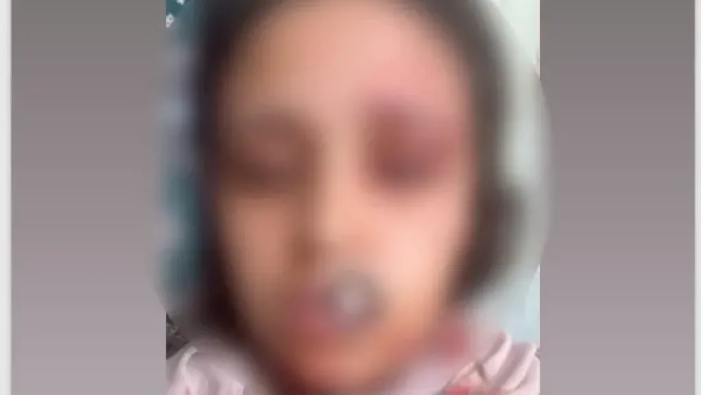الضحية 