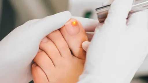علاج فطريات أظافر القدم وأسبابها وطرق الوقاية من تكرار العدوى
