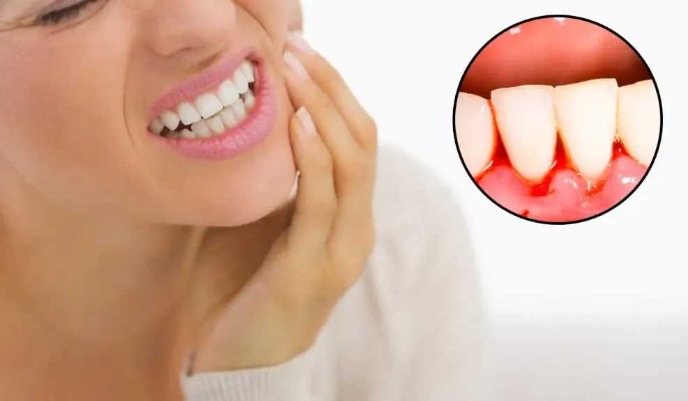 ألم الأسنان ونزيف اللثة.. 4 علامات تحذيرية لا تتجاهلها في فمك