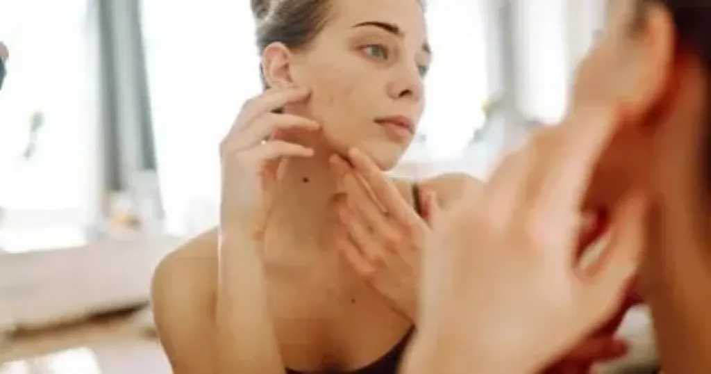 8 مشكلات جلدية شائعة تؤثر على جمال البشرة.. تعرفي على طرق التعامل معها