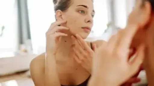 8 مشكلات جلدية شائعة تؤثر على جمال البشرة.. تعرفي على طرق التعامل معها
