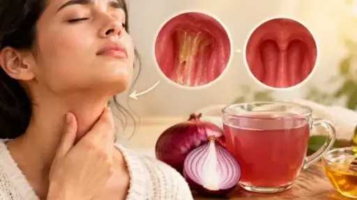 التهاب الحلق والمخاط.. مشروب البصل بالعسل وصفة منزلية قد تساعد على تهدئة الأعراض