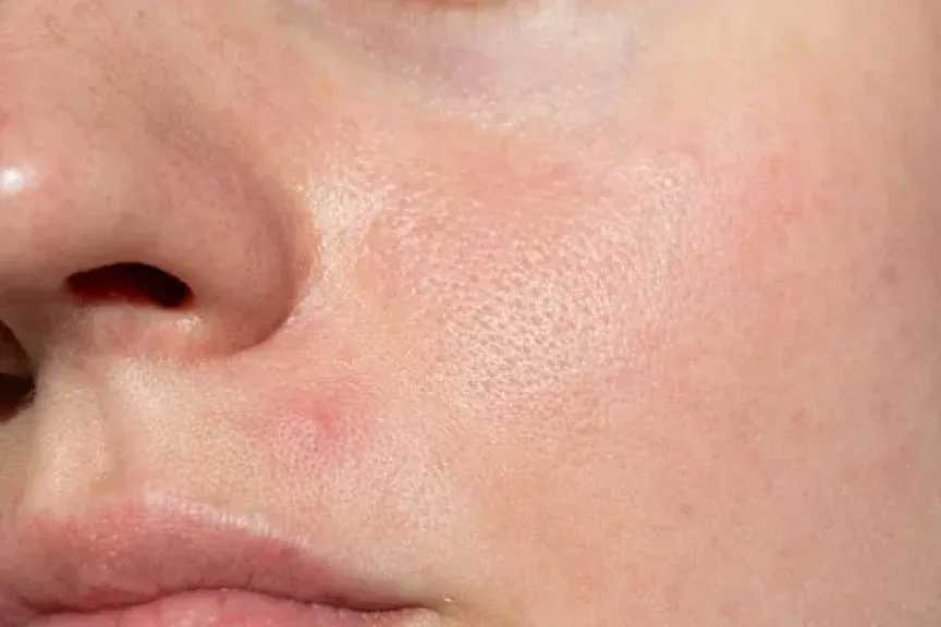 قبل شراء منتجات العناية بالبشرة.. 6 أسئلة مهمة لاختيار الأنسب لنوع بشرتك