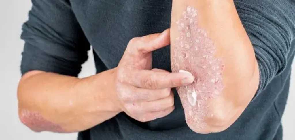 فوائد الزعفران الصحية.. هل يساعد في تخفيف أعراض الربو وضعف الانتصاب؟