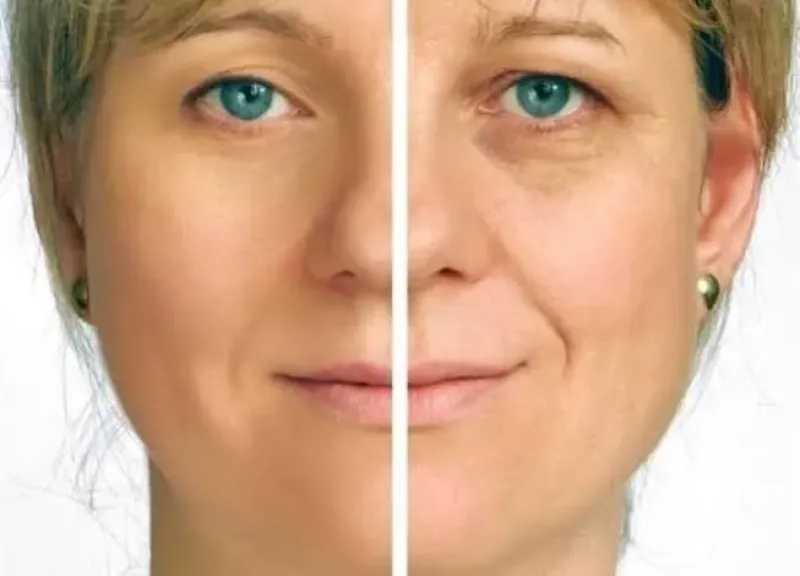 قبل ظهور التجاعيد.. 6 عادات يومية تحذر منها خبيرة التجميل للحفاظ على نضارة البشرة