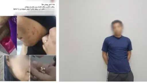 جنزير حديدي وقص شعرها.. كشف ملابسات تعدي زوج على زوجته بوحشية في الدقهلية