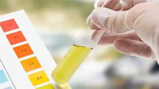 لون البول بيتغير؟ 5 علامات تحذيرية ممكن تكشف عن مشكلة صحية