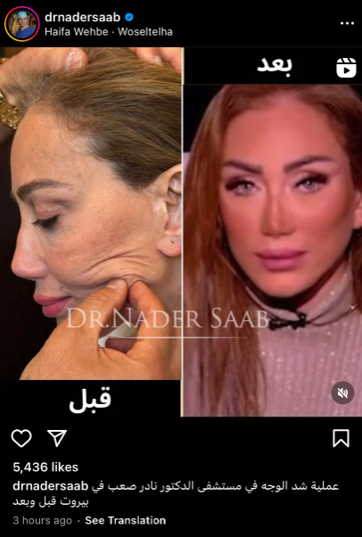 6a422af8f135.png