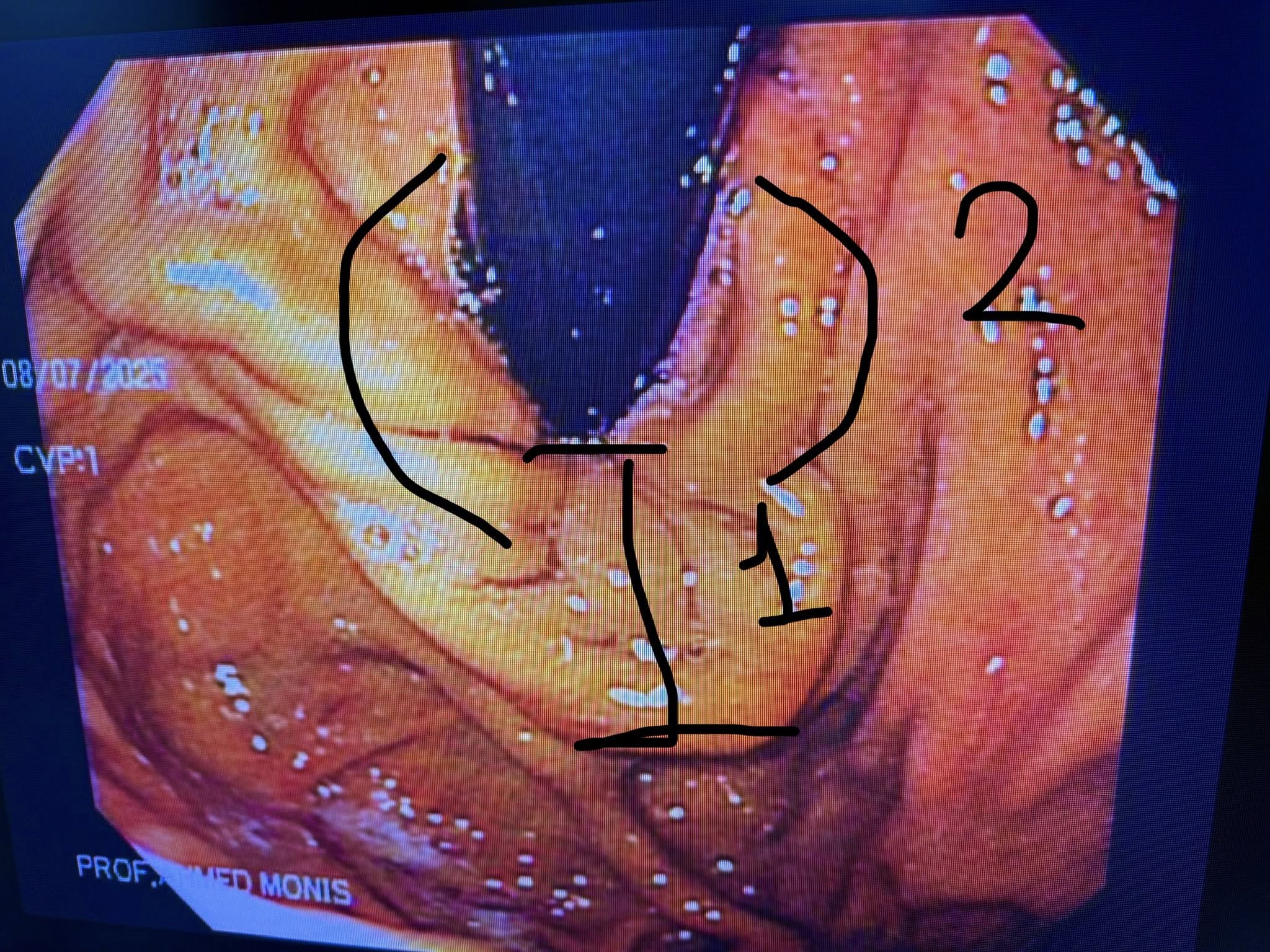 63ef6b6512b0.jpg